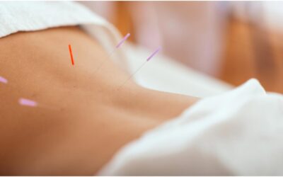 5 bienfaits de l’acupuncture pour la santé